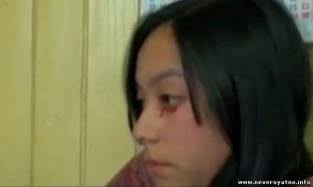 Девушка плачет кровавыми слезами (видео)