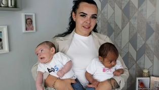 В Британии женщина родила близнецов с разным цветом кожи: в чем причина
