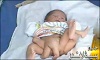 В Пакистане родился мальчик с шестью ногами